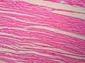 Histology of cardiac muscle