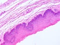 Histology of epiglottis human tissue