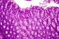 Histology of human appendix, micrograph showing Crypts of Lieberkuhn Royalty Free Stock Photo