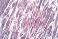 Histology of human cardiac muscle under light microscope view for education Royalty Free Stock Photo