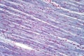 Histology of human cardiac muscle under light microscope view for education Royalty Free Stock Photo