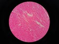 Histology of human cardiac muscle Royalty Free Stock Photo