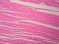 Histology of human cardiac muscle Royalty Free Stock Photo