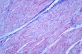 Histology of human cardiac muscle under microscope view for education Royalty Free Stock Photo