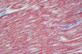 Histology of human cardiac muscle under microscope view for educ Royalty Free Stock Photo