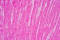 Histology of human cardiac muscle under microscope view for education