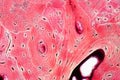 Histology of human compact bone tissue under microscope view for