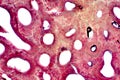 Histology of human compact bone tissue under microscope view for education