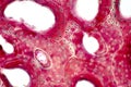 Histology of human compact bone tissue under microscope view for education