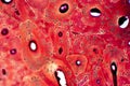 Histology of human compact bone tissue under microscope view for education