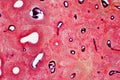 Histology of human compact bone tissue under microscope view for Royalty Free Stock Photo