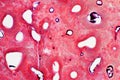 Histology of human compact bone tissue under microscope view for