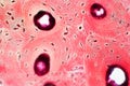 Histology of human compact bone tissue under microscope view for