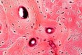 Histology of human compact bone tissue under microscope view for