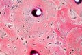 Histology of human compact bone tissue under microscope view for