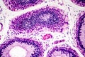 Histology of human epididymis tissue