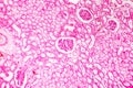 Histology of human kidney Royalty Free Stock Photo