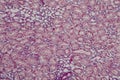 Histology of human kidney under microscope view for education hi Royalty Free Stock Photo