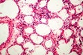 Microscopic photo showing lung tissue