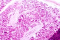 Histology of human pancreatic tissue Royalty Free Stock Photo