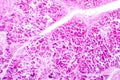 Histology of human pancreatic tissue Royalty Free Stock Photo