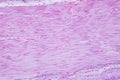 Histology of human smooth muscle under microscope view for education