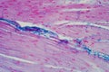 Histology of human smooth muscle under microscope view for education