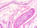 Histology of epiglottis human tissue