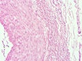 Histology of human adipose tissue Royalty Free Stock Photo