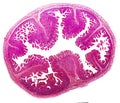 Histology of jejunum, micrograph