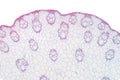 Histology of Monocot stem under the microscope for education