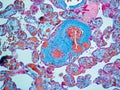 Histology slide of Placenta stained for GAGs