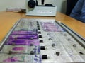 Histopathology slides stained with leishman stain, displayed and ready for microscopy