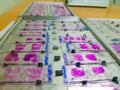 Histopathology slides stained with leishman stain, displayed and ready for microscopy