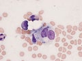 Histoplasma capsulatum in bone marrow. Royalty Free Stock Photo