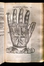 Historical woodcut of an artificial hand