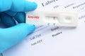 HIV positive test result Royalty Free Stock Photo