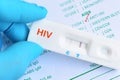 HIV positive test result Royalty Free Stock Photo