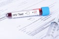 HIV Virus Lab Test form Royalty Free Stock Photo