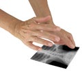 Sending distant healing to woman via photograph of xray