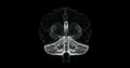 Hologram of cerebrum, cerebellum and medulla oblongata of human body - loop