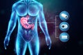 Hologram of an inflamed stomach in a human body and a mini camera, endoscopy procedure Digestive tract and stomach disease concept