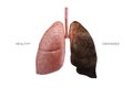 Lungs 3D illustration - Part of Human Organic. Healthy and Damaged Compression.