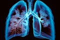 Hologram lung. Pain in the lungs from polygons, triangles, dots and lines. Lung is a low poly compound structure. The