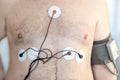 Holter monitor device and daily blood pressure recorder on human male body. Daily cardiogram monitoring. Overweight