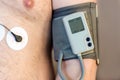 Holter monitor device and daily blood pressure recorder on human male body. Daily cardiogram monitoring. Overweight