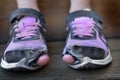 Homeless Child Wearing Old Worn Out Shoes with Holes in them Toes Sticking Out Royalty Free Stock Photo