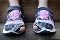 Homeless Child Wearing Old Worn Out Shoes with Holes in them Toes Sticking Out Royalty Free Stock Photo