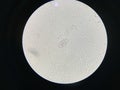 Hook worm eggs of parasite in stool examination