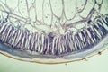 Horse roundworm in cross section with eggs